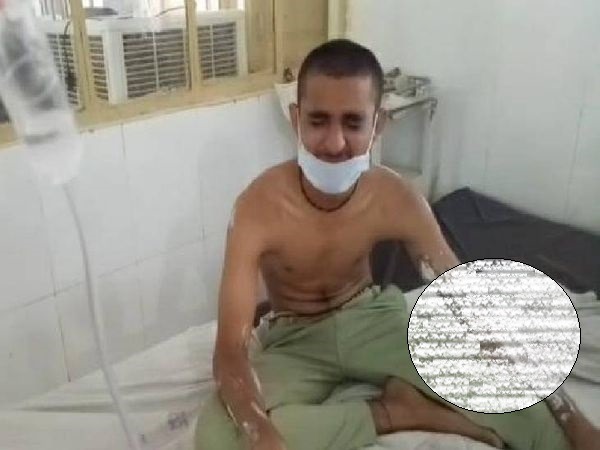 Satna: जमीनी विवाद में एसिड़ अटैक, आधा दर्जन लोग घायल, दोनो पक्षों पर मामला दर्ज